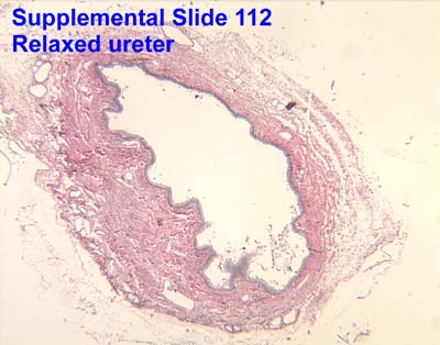 Supplemental Slide 112